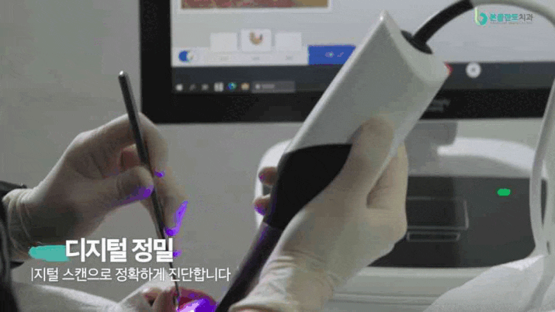 의정부 본플란트 치과, 임플란트 상담 전 먼저 확인해야 할 것