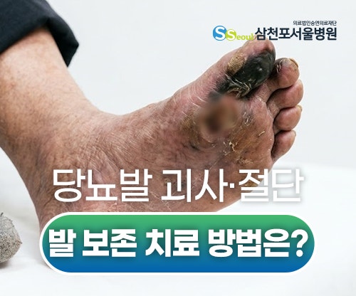 당뇨 발 괴사 및 절단, 발 보존을 위해 선택할 수 있는 치료 방법은?(Ft. 고압산소치료)