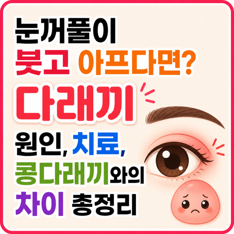 [다래끼] 눈꺼풀이 붓고 아프다면? 다래끼 원인, 치료, 콩다래끼와의 차이 총정리