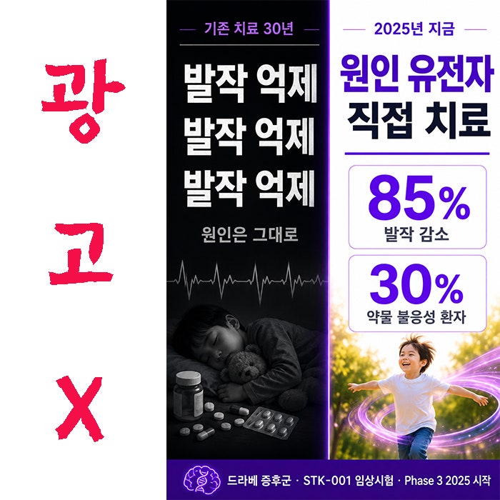 30년간 못 바꾼 간질 치료가 바뀐다