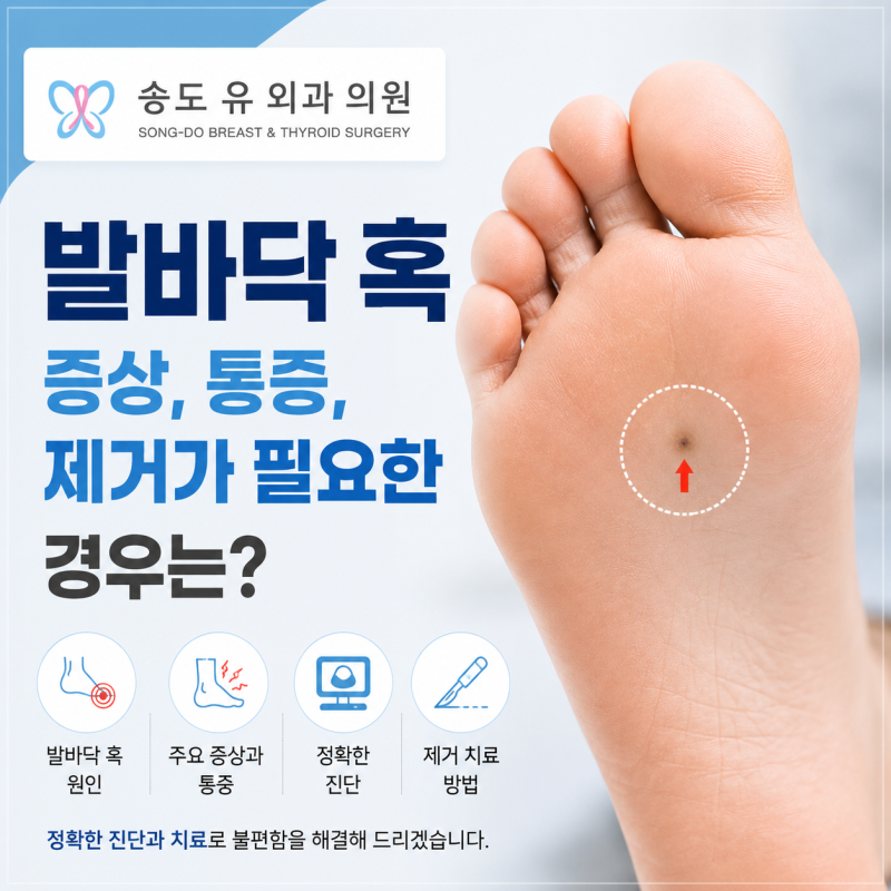 시흥 발바닥 혹 증상, 통증, 제거가 필요한 경우는?