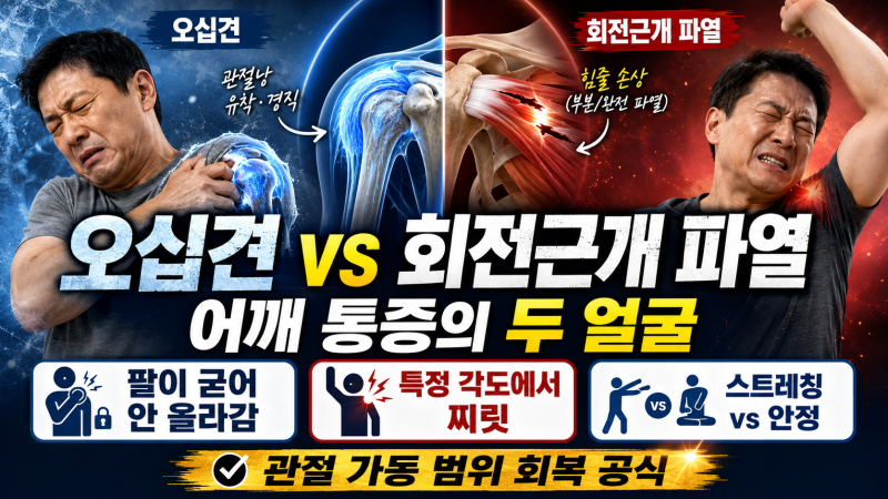 오십견 vs 회전근개 파열, 어깨 통증의 두 얼굴과 관절 가동 범위 회복 공식