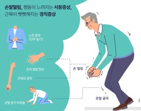 파킨슨씨병