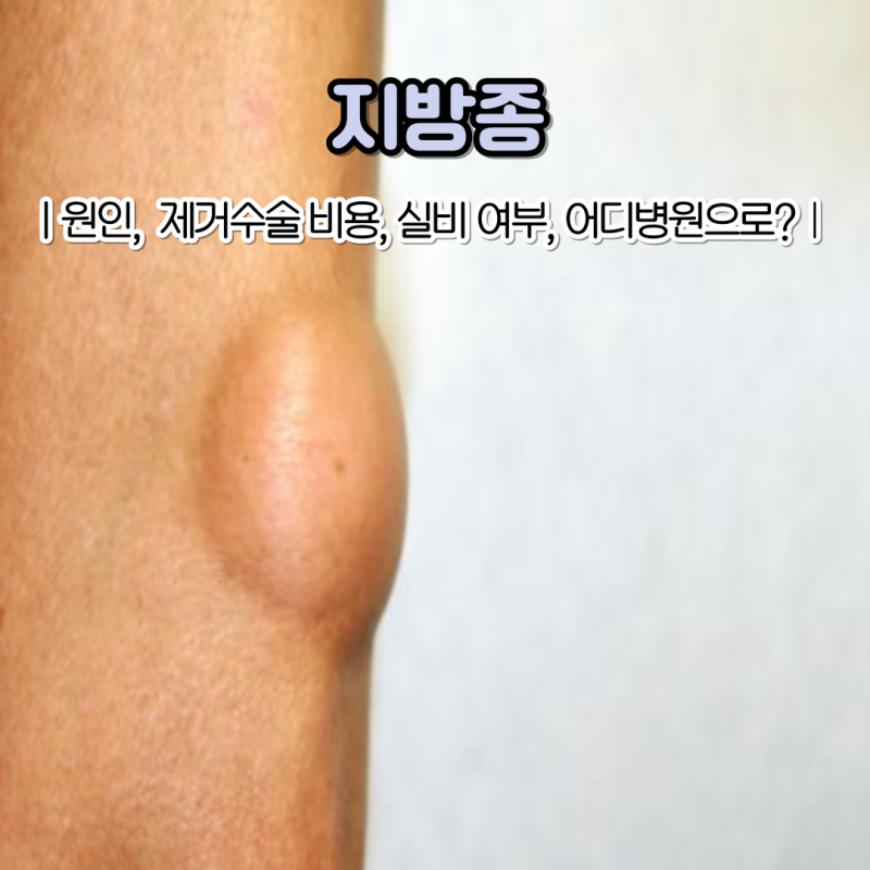 지방종 원인 제거 수술 비용 실비 처리 가능한가요?