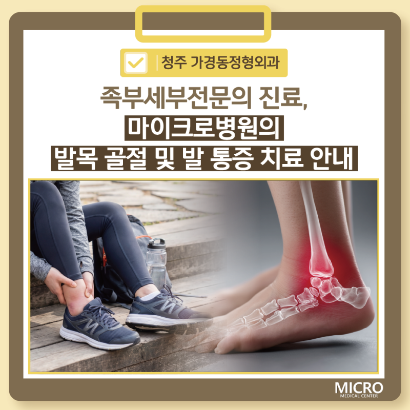 청주 가경동정형외과 족부세부전문의 진료, 마이크로병원의 발목 골절 및 발 통증 치료 안내