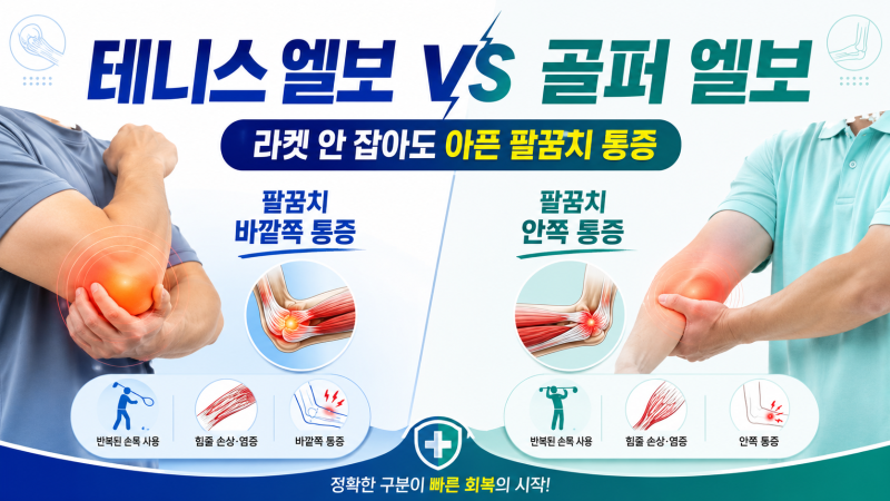 테니스 엘보 vs 골퍼 엘보, 라켓 안 잡아도 아픈 팔꿈치 통증과 힘줄 재생 공식