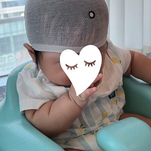 아기 사두 단두 진료 후기 두상 교정헬멧 단두증 사두증 / 대구더채움재활의학과의원(+아이....