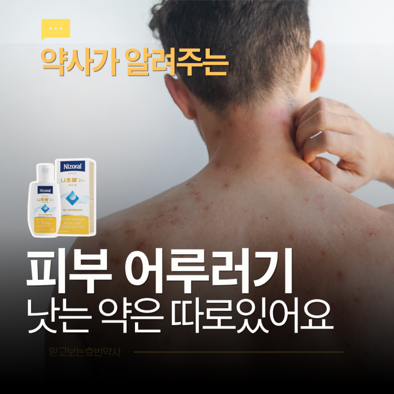 어루러기 여름에 왜 심해질까? 어루러기 낫는약으로 니조랄을 추천하는 이유까지 약사가 알....