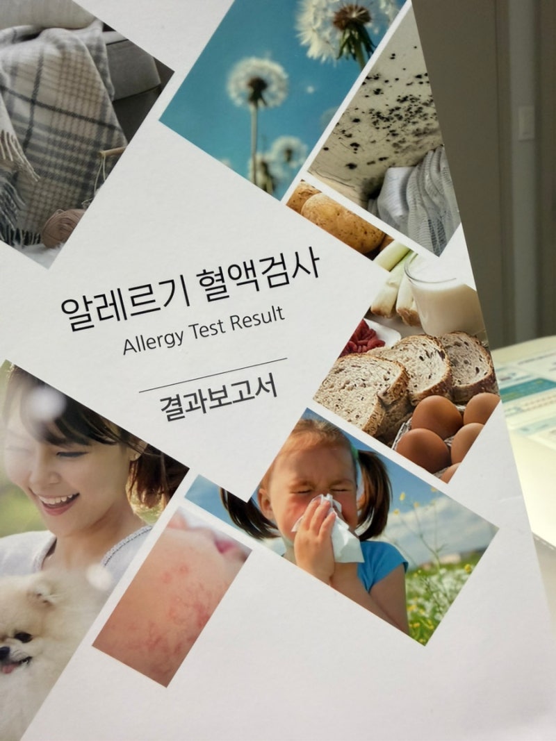 서울 지연성 알러지 검사(만성 음식물 알레르기 IgG 검사) 후기! 음식물 과민증