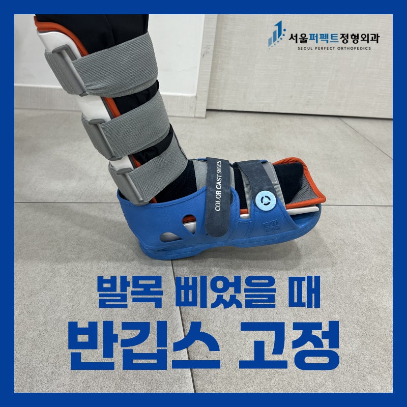 발목 삐었을때 반깁스 고정이 중요한 이유(30대 남성 치료 후기)
