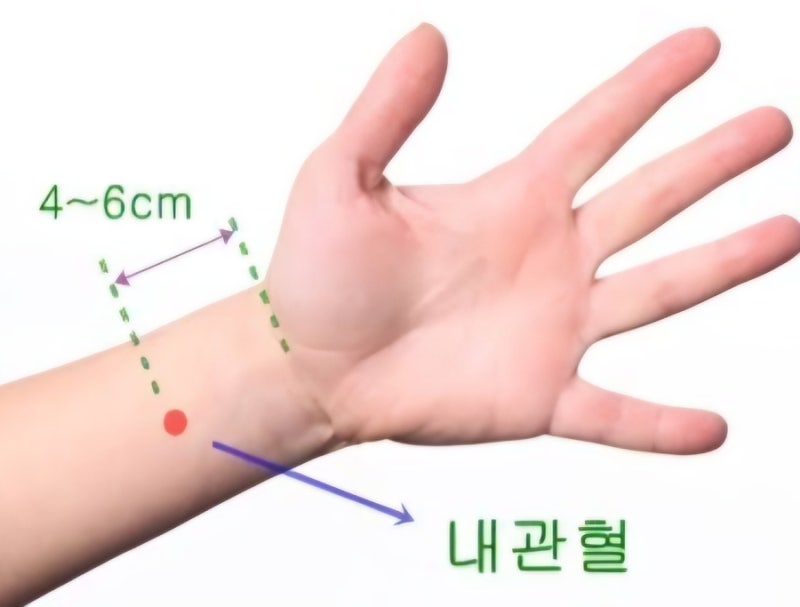 내관혈, 속이 메스꺼울때, 멀미&입덧 밴드가 누르는 그 혈자리