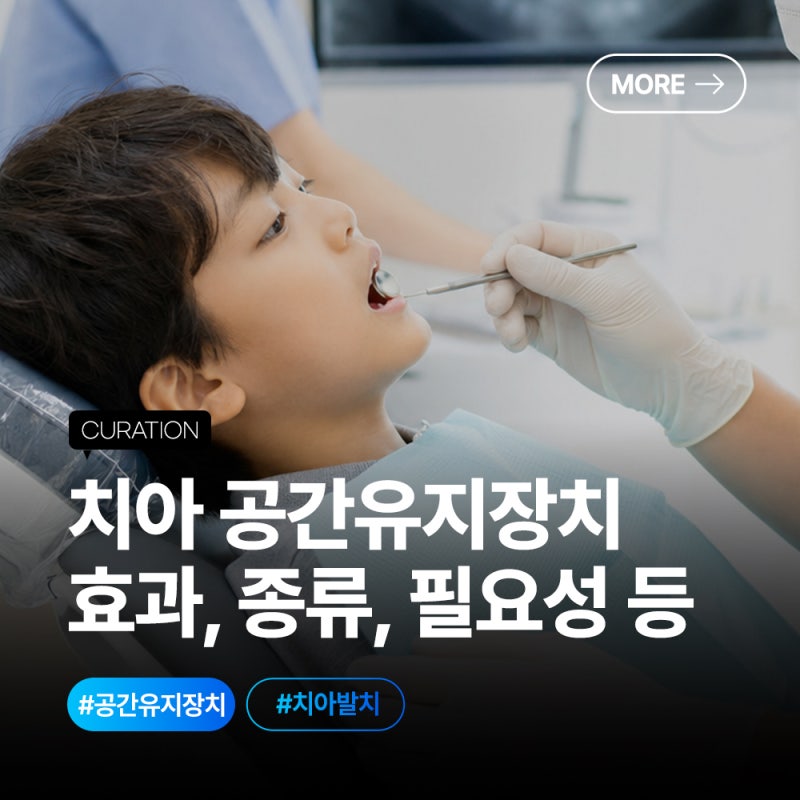 치아 공간유지장치 기간, 비용, 제거, 종류, 필요성 등 치과 정보 총정리