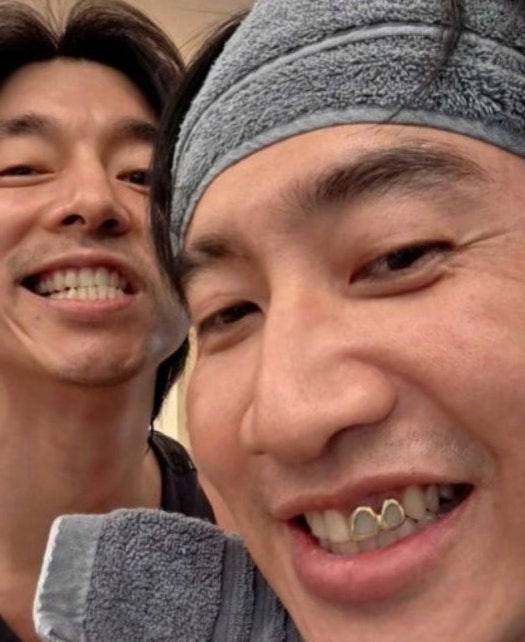 이광수 쌍커플 이빨 금니 언급되는 이유?
