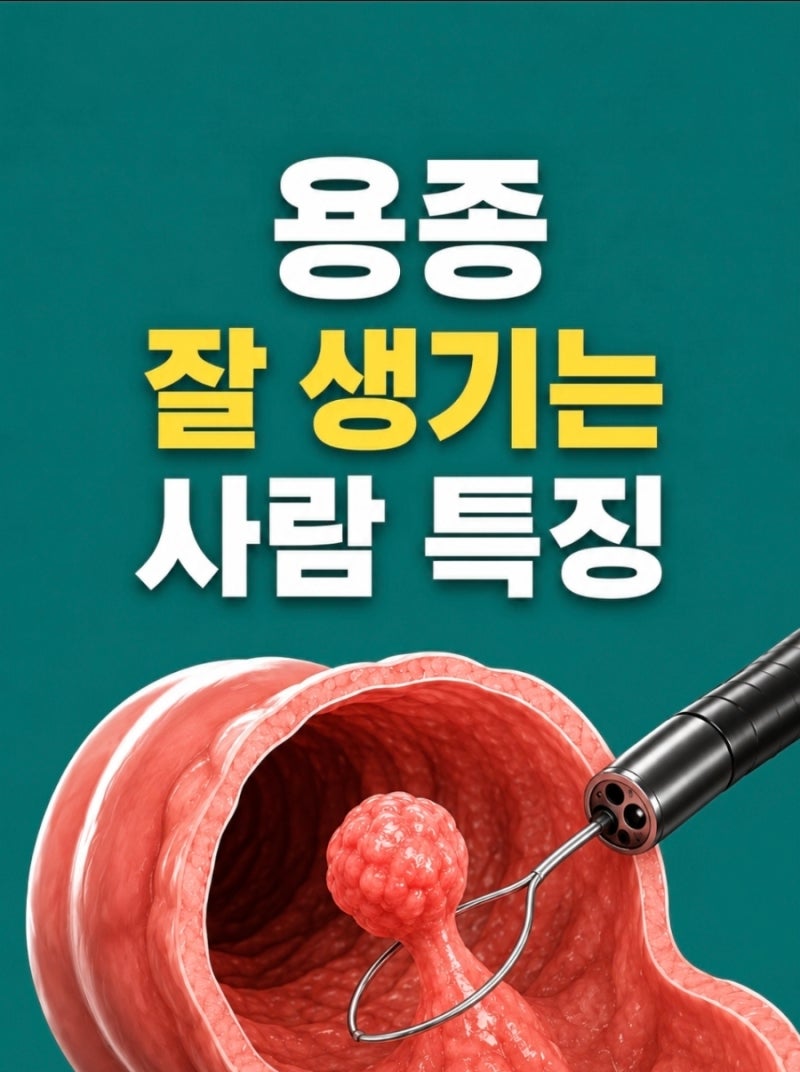 『대장 용종 잘 생기는 사람 특징 7가지』대장내시경 나이·용종 제거 후 주의사항