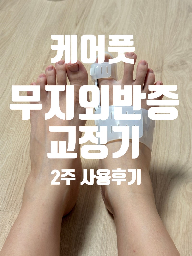 케어풋 무지외반증교정기 발가락교정밴드 2주 후기