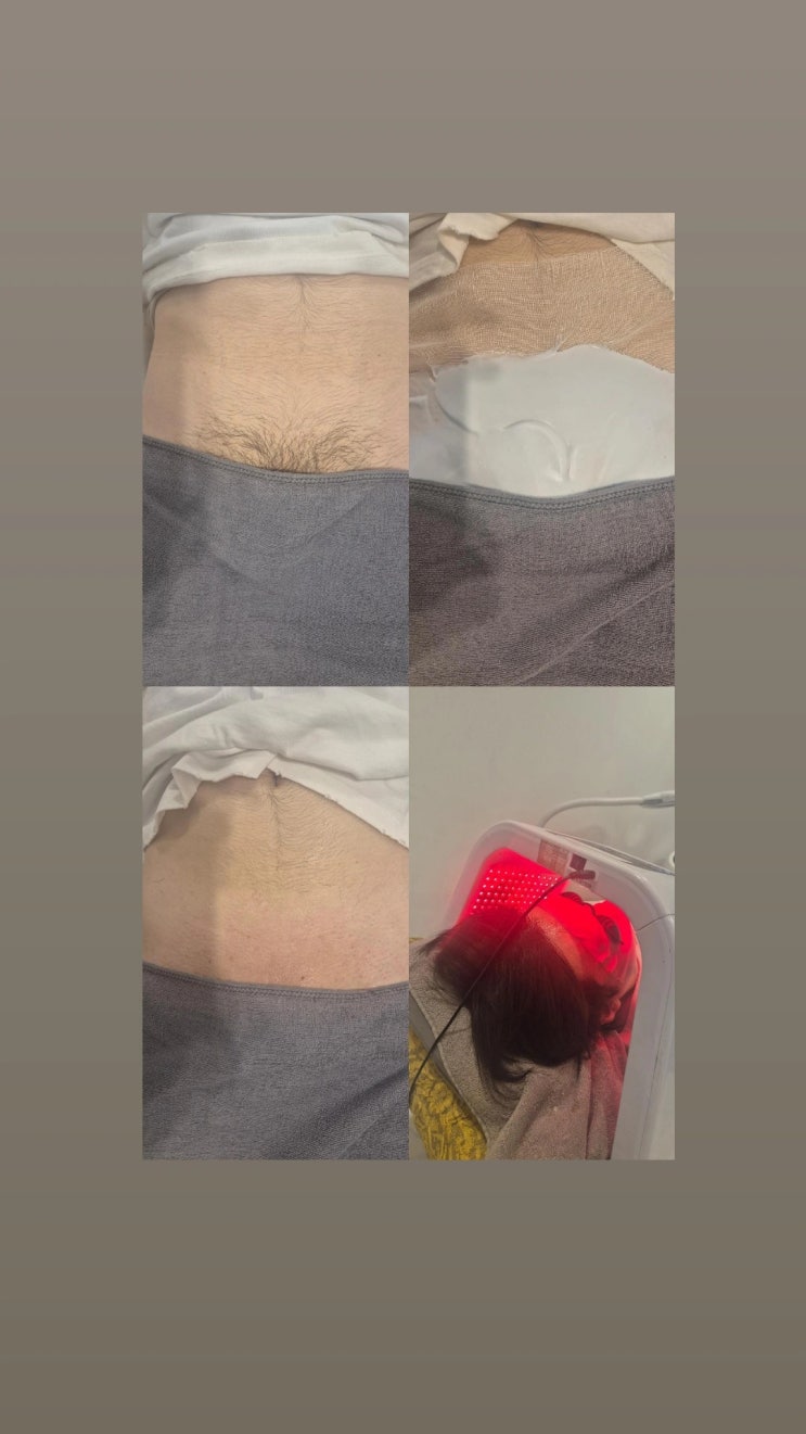  남자 브라질리언 왁싱을 받으시면 진정케어 풀세트가 무료로 따라 옵니다. 영등포 왁싱샵 "청춘케어"