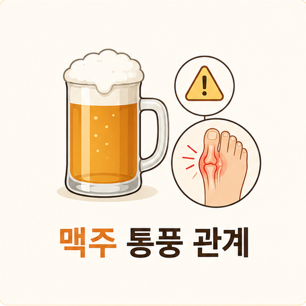 맥주 통풍 관계 그리고 무알콜 제로맥주는 괜찮을까?