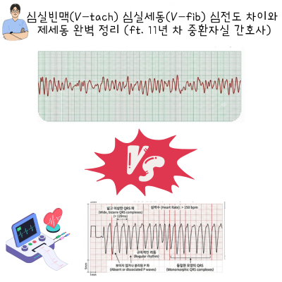 심실빈맥(V-tach) 심실세동(V-fib) 심전도 차이와 제세동 완벽 정리 (ft. 11년 차 중환자실 간호사)