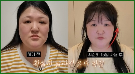 이국주 턱선 관리 애프터와 민낯 자신감 근황