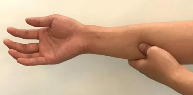 급하게 화장실 가고 싶을 때, 장문혈 이야기