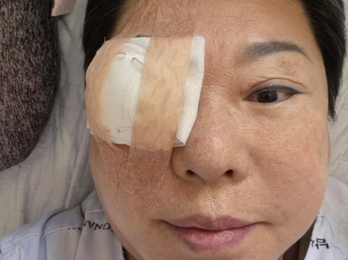 누워있어요" 가수 <b>양희은</b>, <b>각막이식 수술</b> 후 가슴 뭉클한 <b>근황</b>