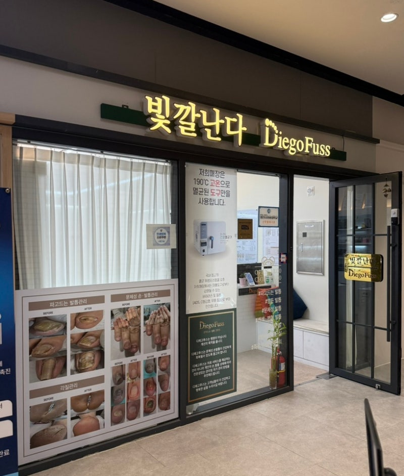 인천 문제성발톱 전문 빛깔난다 후기