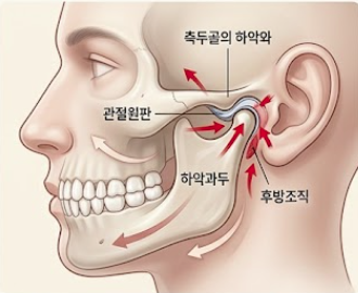 [의학 공부] 턱관절의 엇갈린 톱니바퀴 — 측두하악관절장애(TMD)와 관절원판(Disk)의 물리적 ....