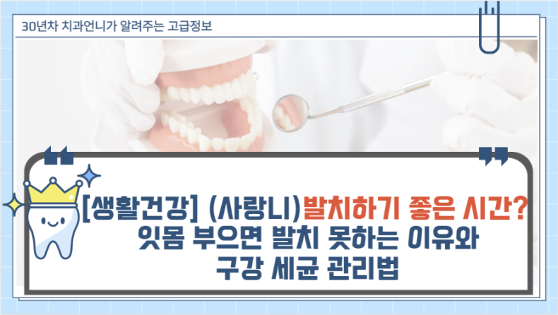 [생활건강] 사랑니 뽑기 좋은 시간? 잇몸 부으면 발치 못하는 이유와 구강 세균 관리법