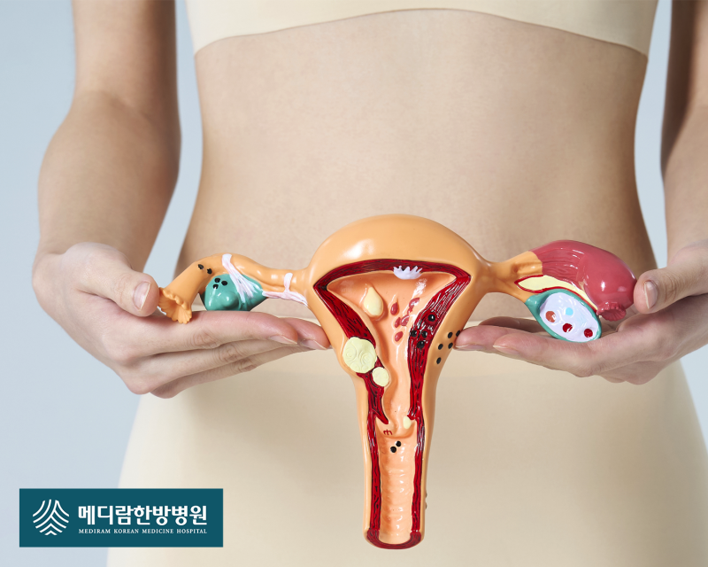 난소암 생존율, 재발률 높아 미리 대처해야 한다