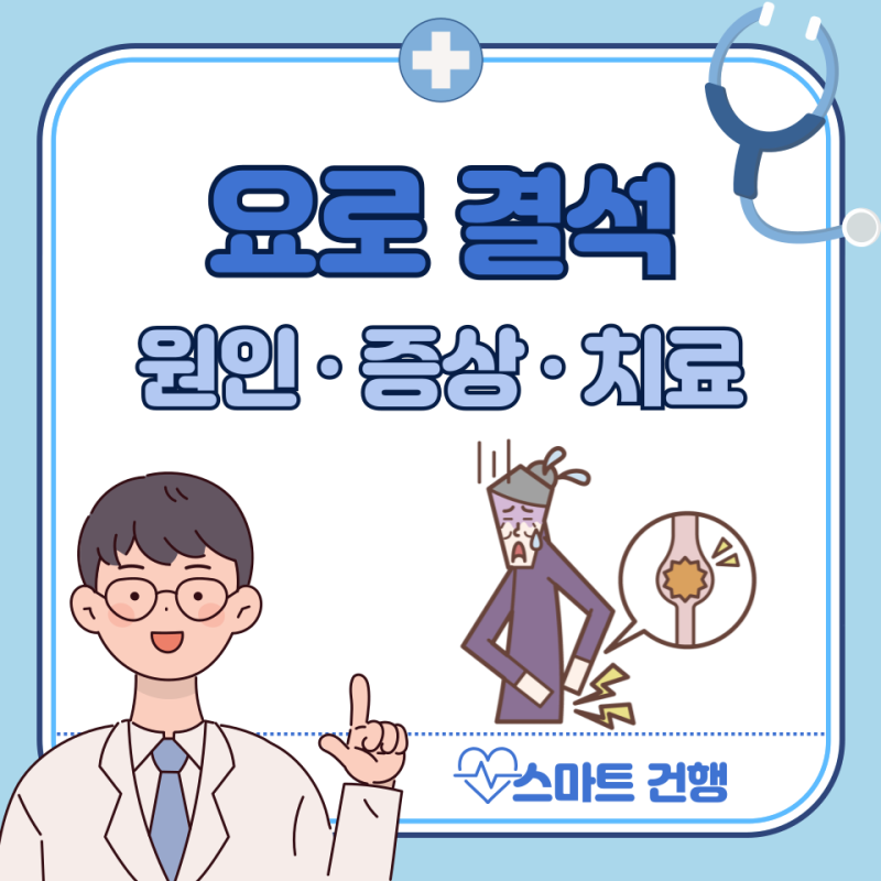 요로결석 통증 부위, 제거, 수술 : 남자 여자 증상
