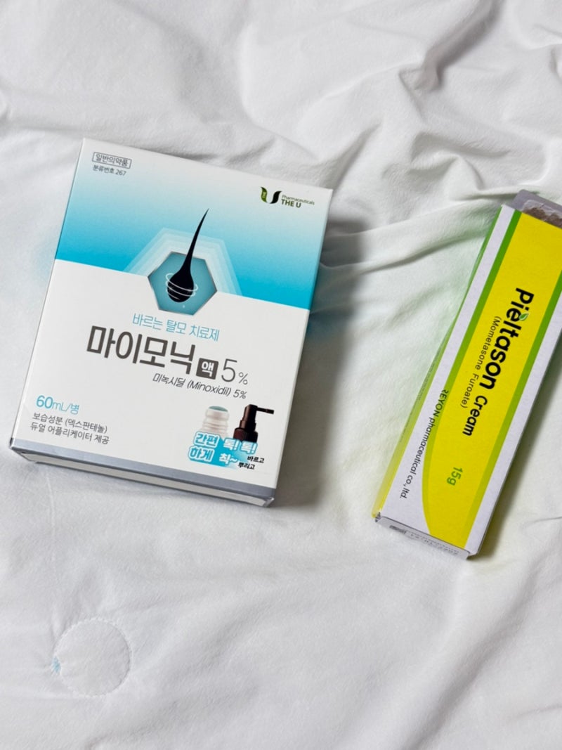 여자 원형탈모 치료 피부과 치료 후기｜스테로이드 주사치료