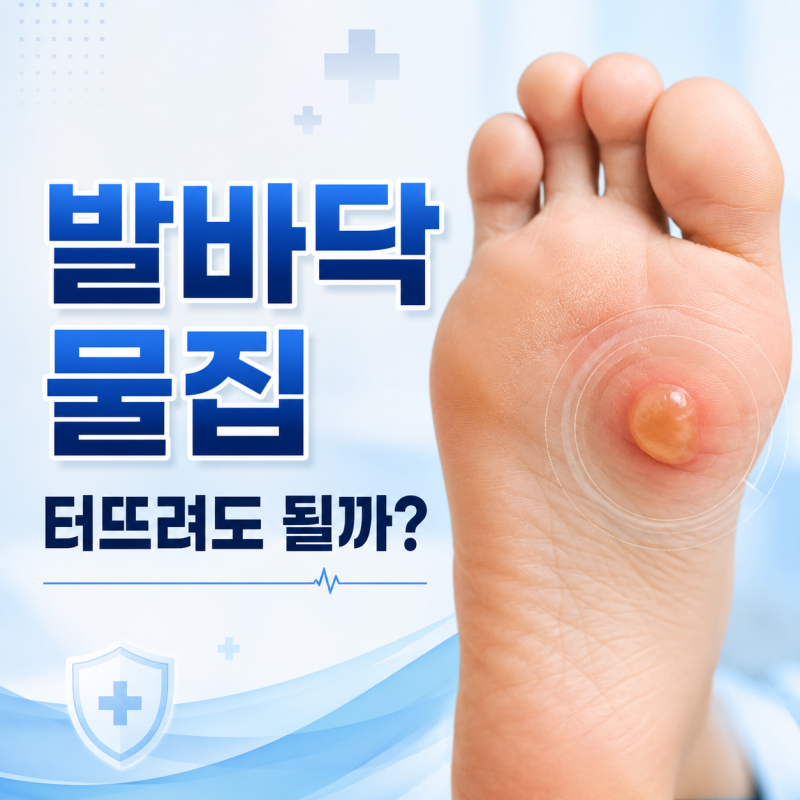 발바닥 물집, 터뜨려도 될까? 그냥 둬야 하는 경우
