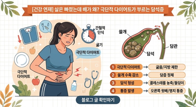 살은 빠졌는데 배가 콕콕? 극단적 다이어트가 부르는 쓸개의 비명, '담석증'