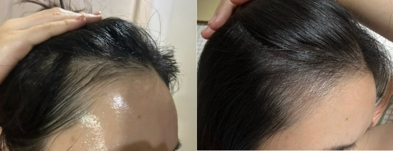 리바이탈래쉬 헤어 볼륨 인핸싱 폼 2개월 내돈내산 후기
