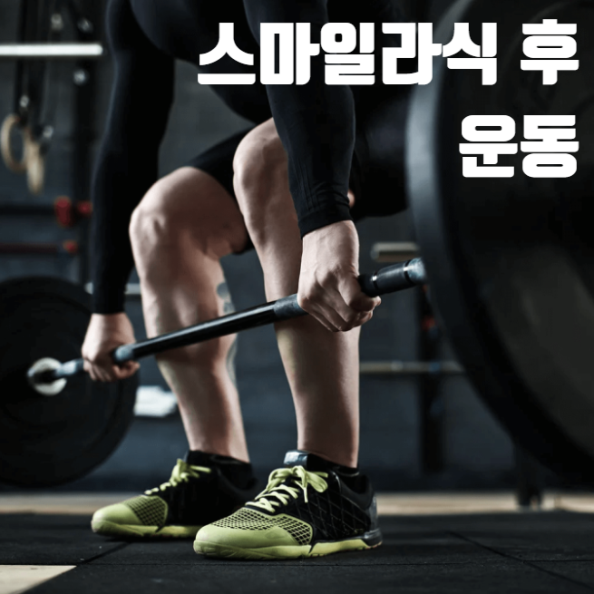 스마일라식 후 운동은 언제부터? 빠른 시력 회복을 위한 꿀팁