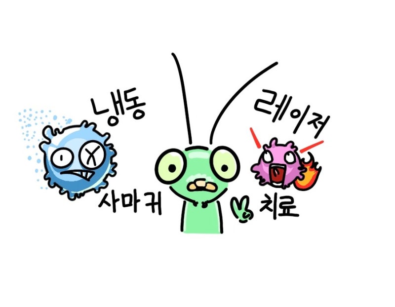 사마귀 치료 고민 중이면 필독 글