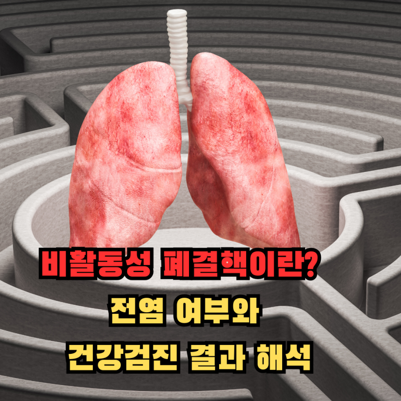 비활동성 폐결핵이란? 전염 여부와 건강검진 결과 해석