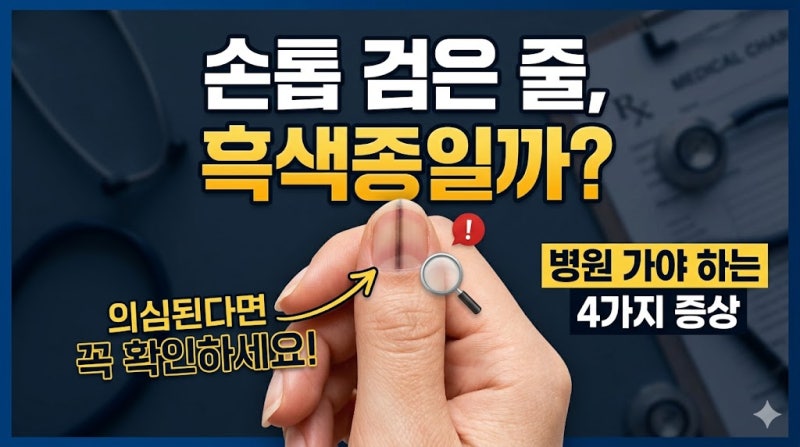 손톱 검은세로줄 혹시 흑색종일까, 의심된다면 확인해야 할 3가지