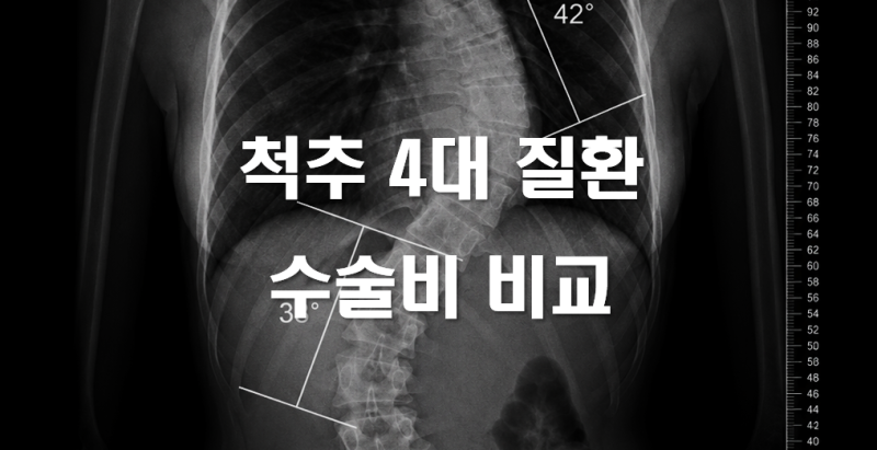 척추 4대 질환 수술비 | 척추협착증·측만증·전방전위증·분리증, 실손보험 수술비용