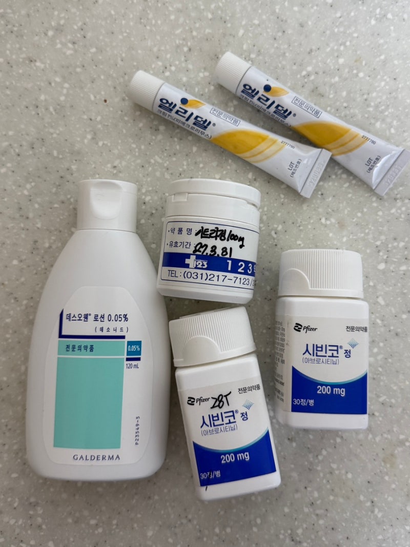 중증 아토피 피부염 산정특례 지정 기준과 시빈코 투약 치료 후기