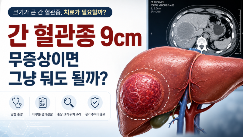 9cm 간 혈관종, 무증상이면 정말 그냥 둬도 될까?