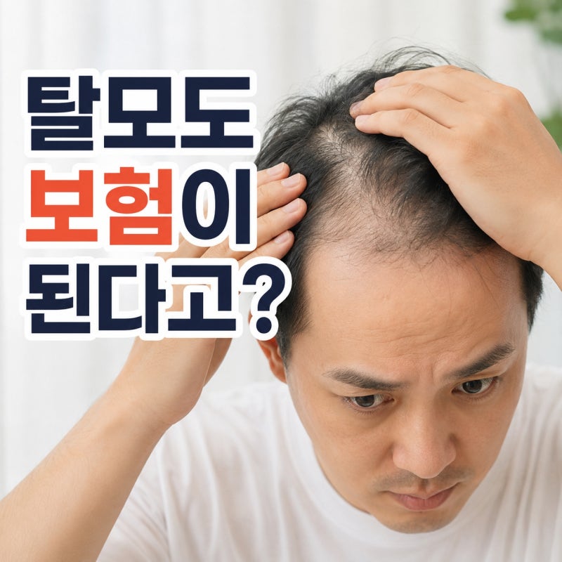 원형탈모 건강보험 확대, 7월부터 치료비 얼마나 줄어들까?
