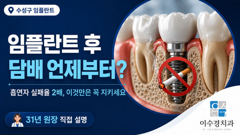 임플란트 수술 후 담배 언제부터 피울 수 있나요? | 수성구 치과 원장 직접 답변