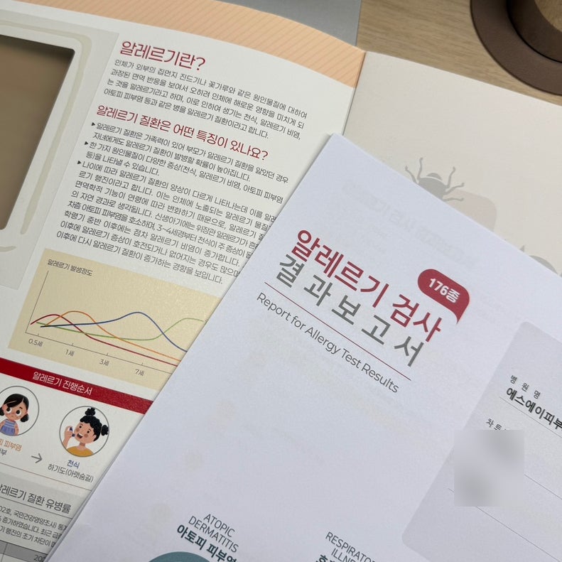 대전 노은 SA피부과, 176종 알레르기 검사 비용 & 후기