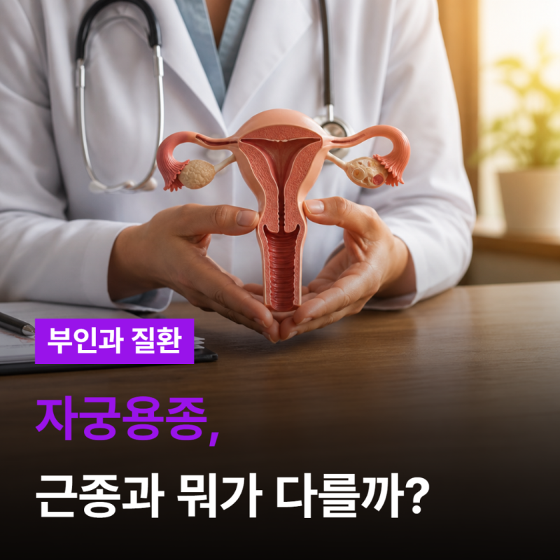 자궁용종은 물혹일까?자궁근종·내막증식증과의 차이 정리[모란여성병원]