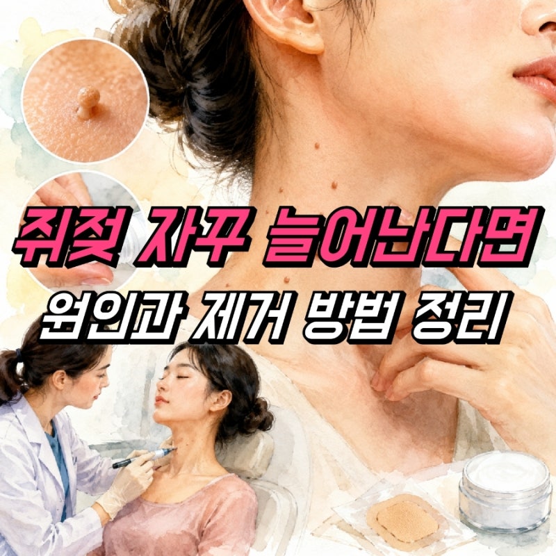 쥐젖 제거 크림 패치, 피부과 치료 방법 비용