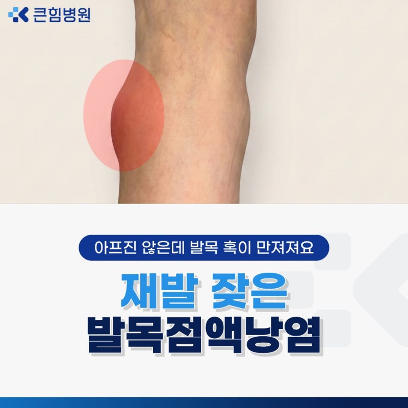 발목점액낭염 치료, 자꾸 재발하는 발목에 물참 증상 해결 방법은?