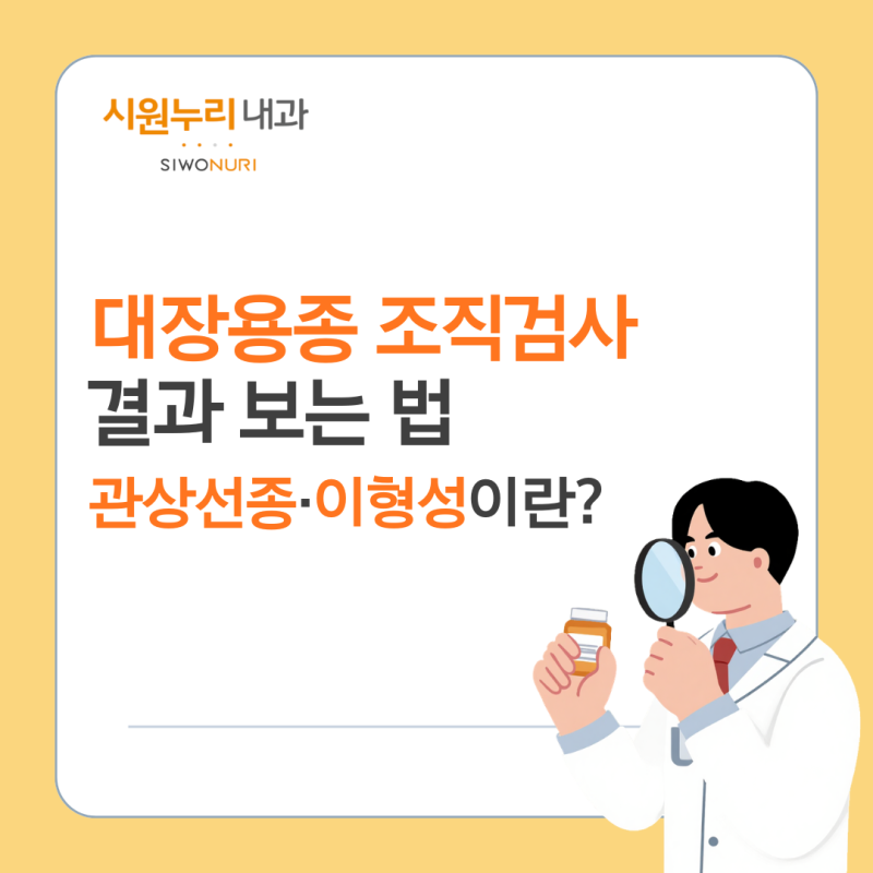 대장용종 조직검사 결과 보는 법, 관상선종·이형성이란?