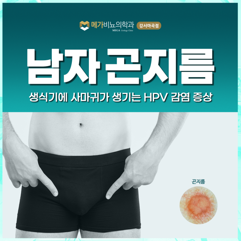 남자 곤지름 증상 재발 하지 않게 완치할 순 없을까