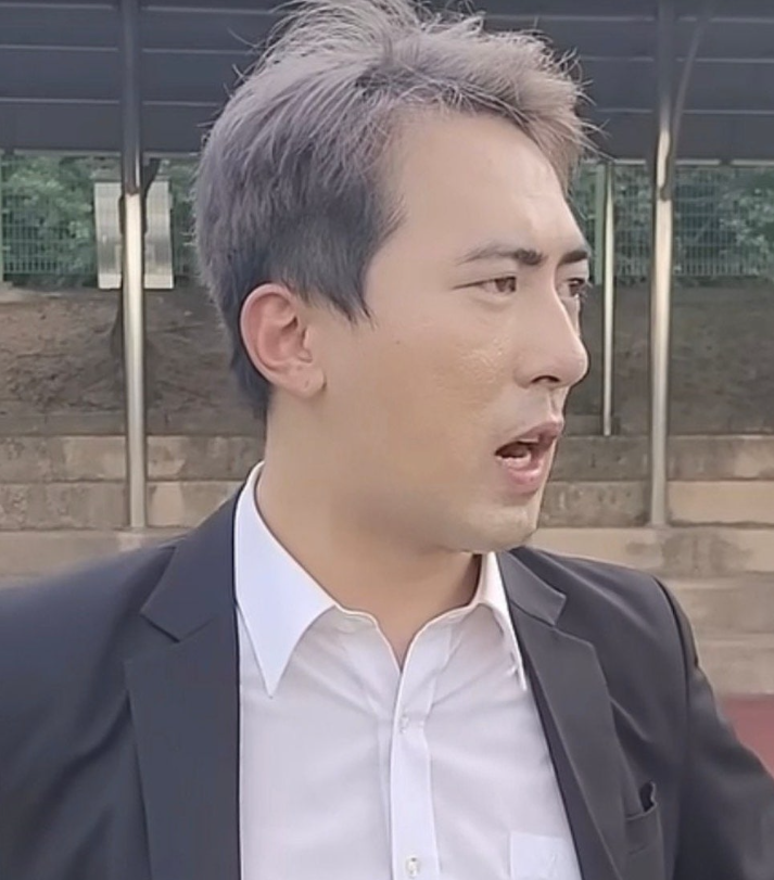 "모발 4000모 이식의 위력"…김원훈 분위기가 완전히 달라졌다